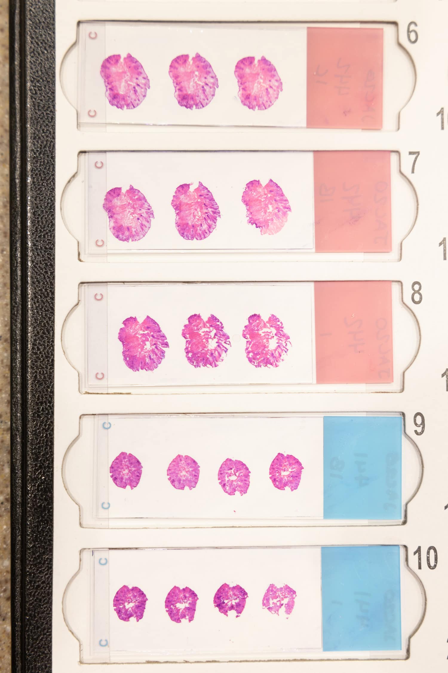 Close up of dermapathology slide