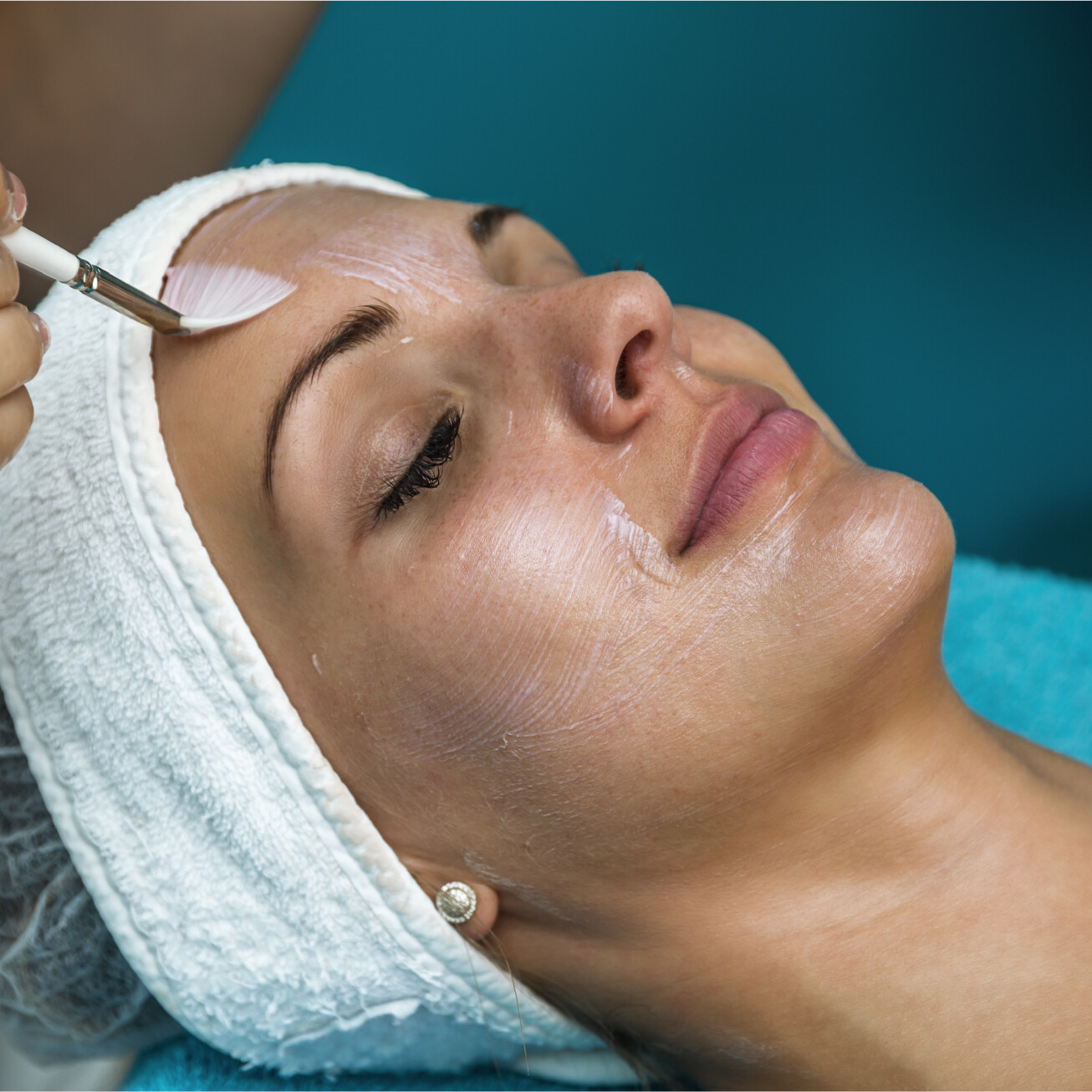A provider uses a brush to gently apply a chemical peel to a patient's face